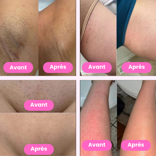 Lady Shaver • Épilateur Électrique 